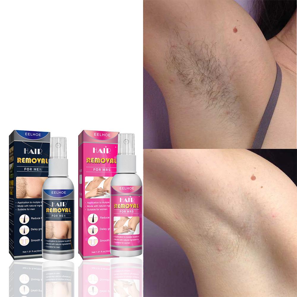 1/2 Uds. Depiladora permanente - Body Lotion reseña y precio